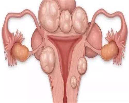 杭州卵子质量差_高龄女性的助孕全解析-嘉禧孕育