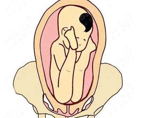 有生理缺陷或疾病不能生育子宫内膜薄不孕怎么办_杭州专业团队帮您好孕