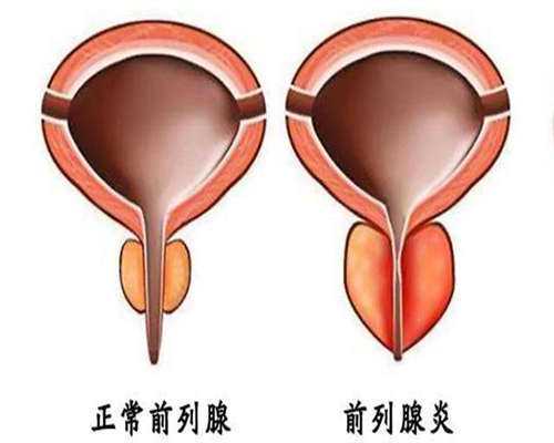 杭州微刺激方案