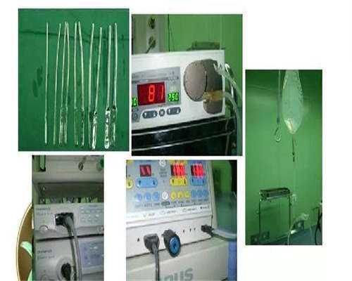 单角子宫试管杭州