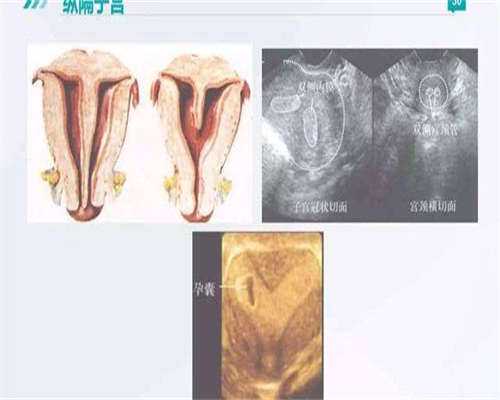 杭州MRKH综合征费用流程_有生理缺陷或疾病不能生育圆梦攻略